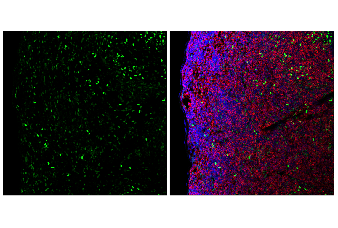 Immunofluorescence Image 3: TCF4/ITF2 (E3X2Y) Rabbit mAb