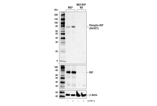 Western Blotting Image 3: Phospho-RIP (Ser321) (E9K2A) Rabbit mAb