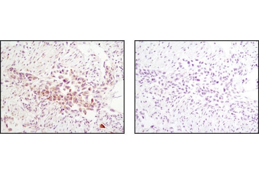 Immunohistochemistry Image 1: Jak2 (D2E12) XP<sup>®</sup> Rabbit mAb (BSA and Azide Free)