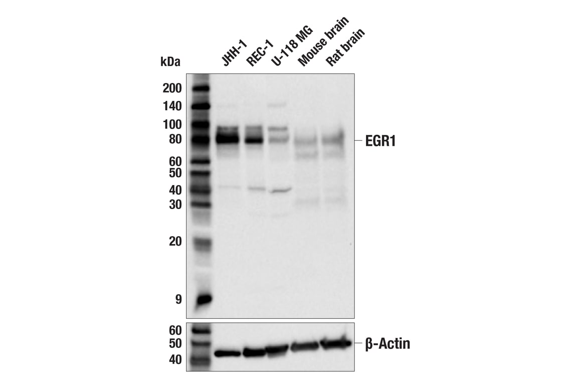 Western Blotting Image 2: EGR1 (44D5) Rabbit mAb