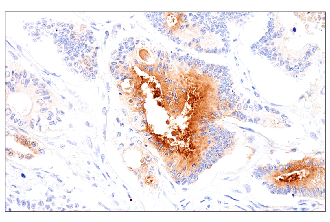 Immunohistochemistry Image 2: Folate Receptor Alpha/FOLR1 (BN3.2) Mouse mAb