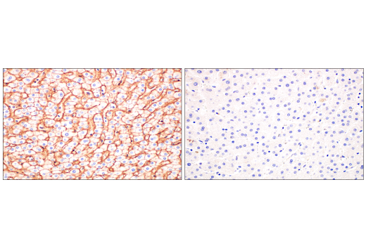 Immunohistochemistry Image 10: CD81 (D3N2D) Rabbit mAb