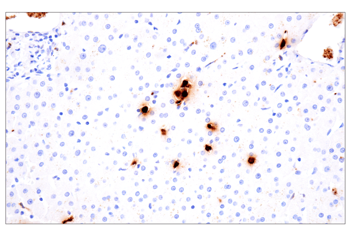 Immunohistochemistry Image 9: Neutrophil Elastase (F4H3X) Rabbit mAb (BSA and Azide Free)