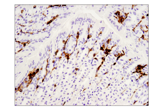 Immunohistochemistry Image 2: CD45 (D3F8Q) Rabbit mAb (BSA and Azide Free)
