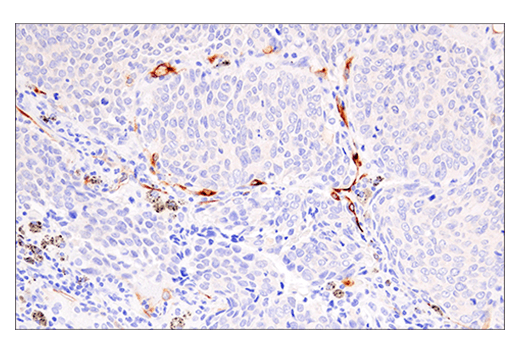 Immunohistochemistry Image 3: HLA-G (E8N9C) XP<sup>®</sup> Rabbit mAb