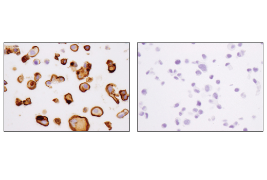 Immunohistochemistry Image 2: MUC1-C (D5K9I) XP<sup>®</sup> Rabbit mAb (BSA and Azide Free)