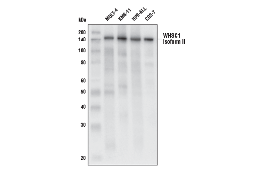 Western Blotting Image 1: WHSC1 (D4Z8Q) Rabbit mAb