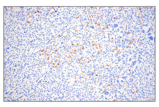 Immunohistochemistry Image 1: Phospho-SLP-76 (Ser376) (E3G9U) XP<sup>®</sup> Rabbit mAb