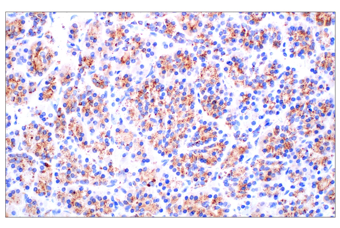 Immunohistochemistry Image 5: Cathepsin D (E5V4H) Rabbit mAb