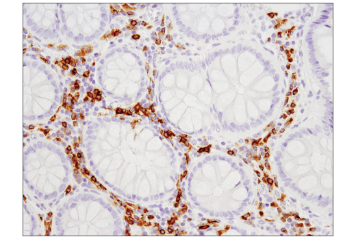 Immunohistochemistry Image 3: CD79B (D7V2F) Rabbit mAb