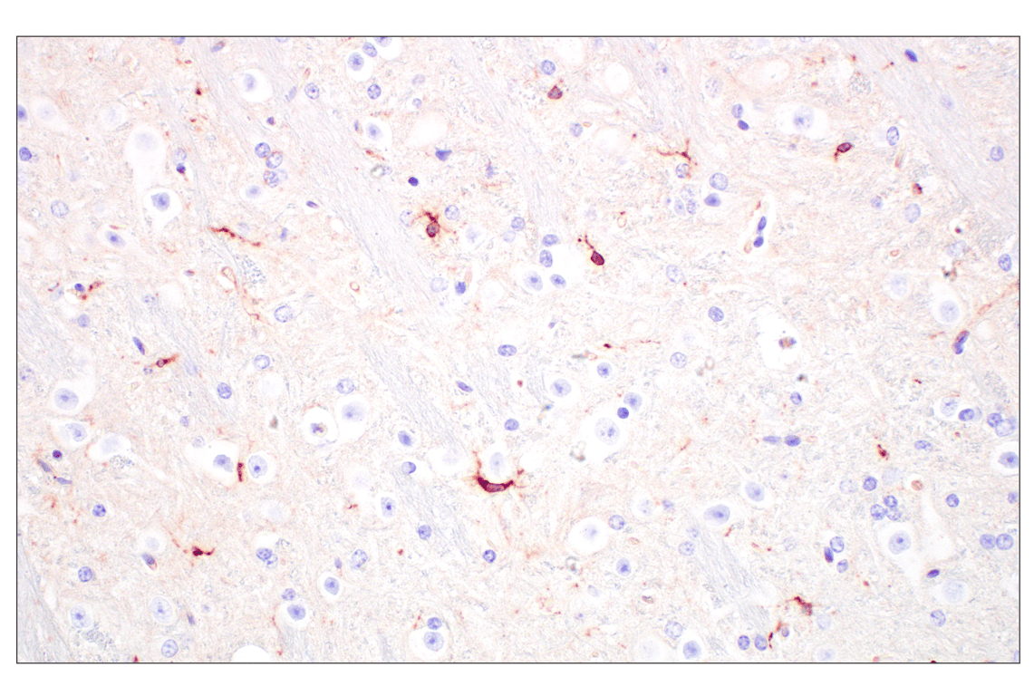 Immunohistochemistry Image 4: C1QB (E3U6X) Rabbit mAb (BSA and Azide Free)