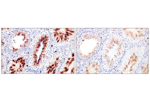 undefined Image 75: Mouse Reactive M1 vs M2 Macrophage IHC Antibody Sampler Kit