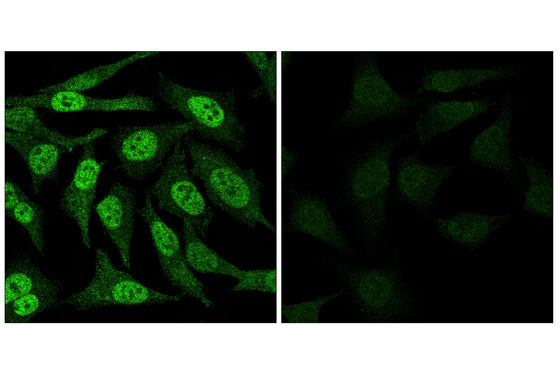 undefined Image 51: ALK Activation Antibody Sampler Kit