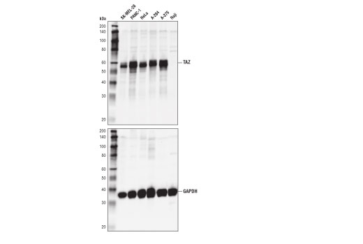 undefined Image 7: Hippo Pathway: Upstream Signaling Antibody Sampler Kit