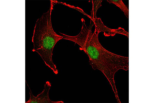 Immunofluorescence Image 1: Ubc9 (D26F2) XP<sup>®</sup> Rabbit mAb