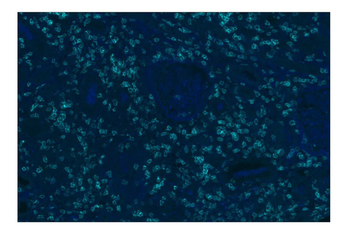 Immunohistochemistry Image 1: CD8α (D8A8Y) Rabbit mAb (Alexa Fluor® 750 Conjugate)