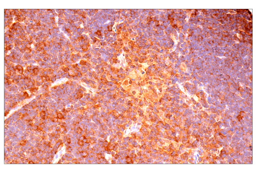 Immunohistochemistry Image 8: p70 S6 Kinase (E8K6T) XP<sup>®</sup> Rabbit mAb