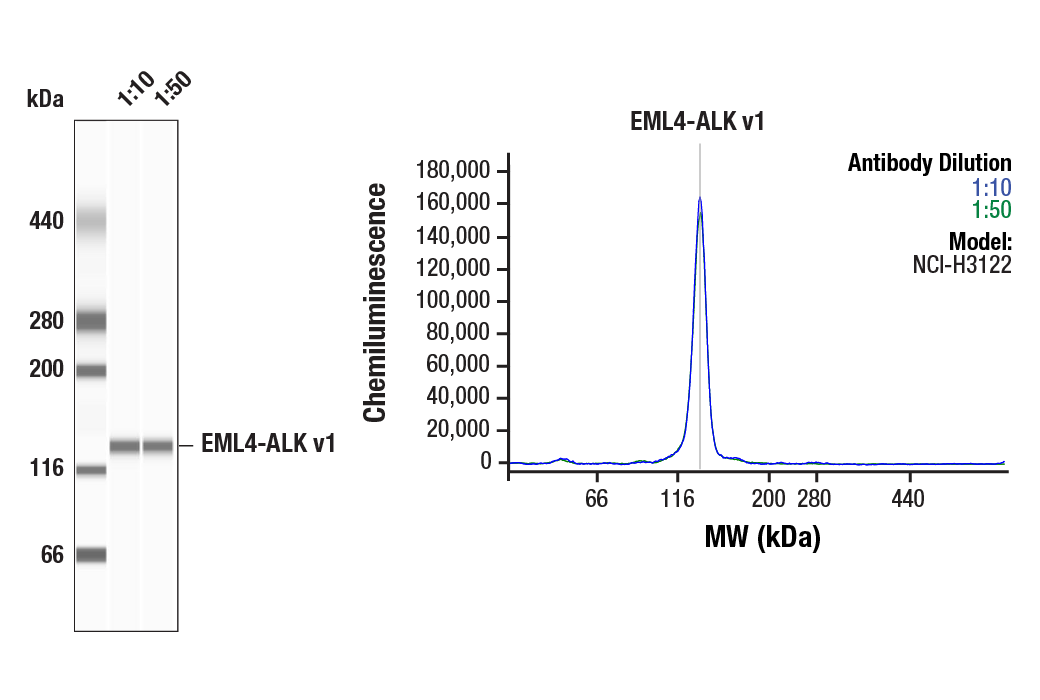 Western Blotting Image 1: ALK (D5F3<sup>®</sup>) XP<sup>®</sup> Rabbit mAb