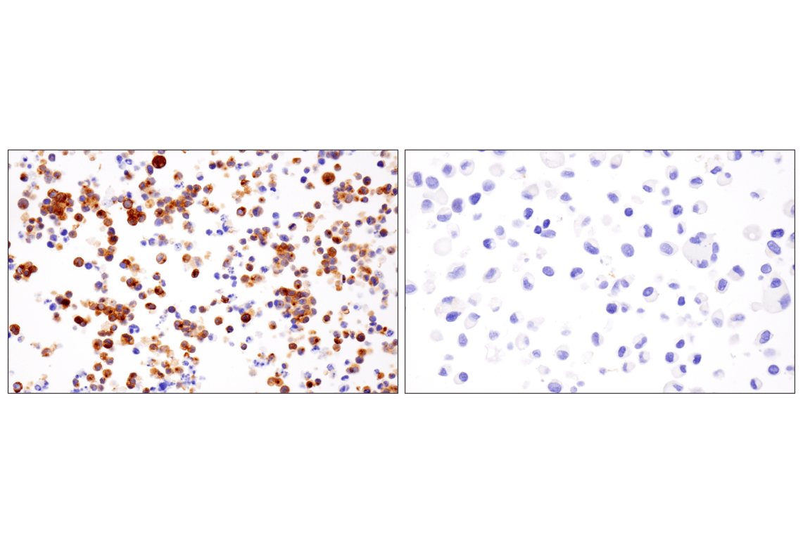 Immunohistochemistry Image 6: VGLUT2 (F1T6V) Rabbit mAb