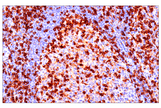 Immunohistochemistry Image 7: CD4 (EP204) Rabbit mAb