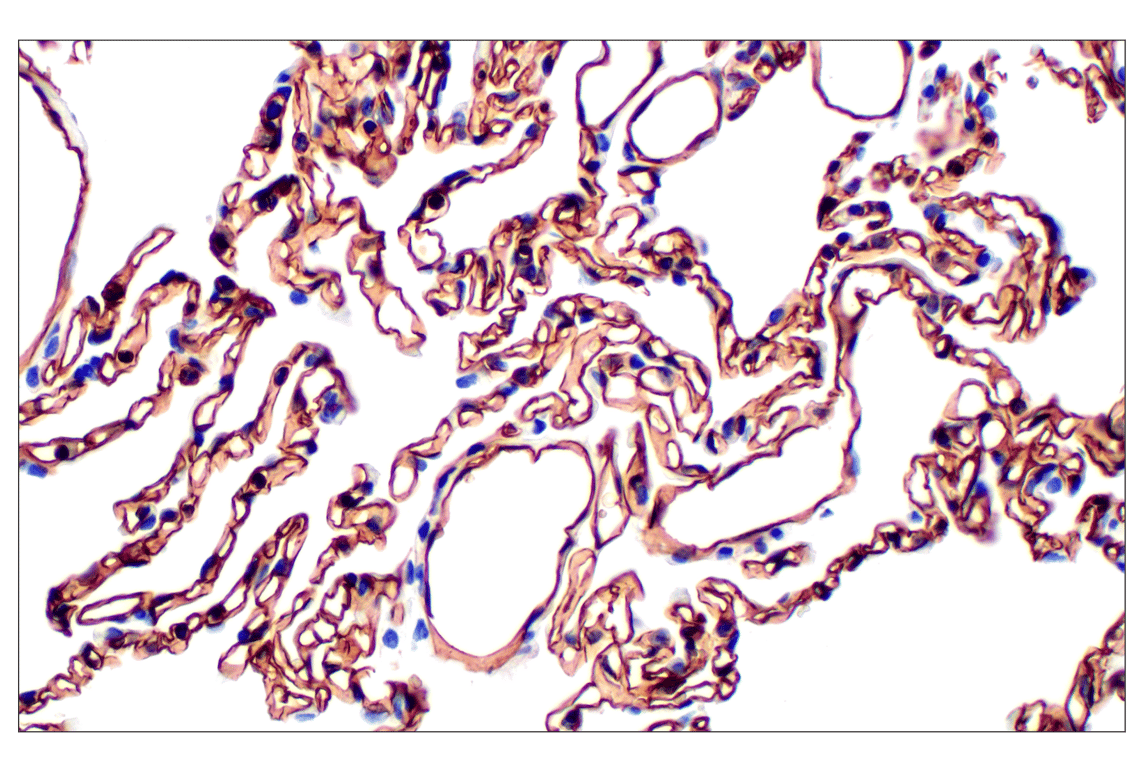 Immunohistochemistry Image 2: CD31 (PECAM-1) (F8M3S) Rabbit mAb (BSA and Azide Free)