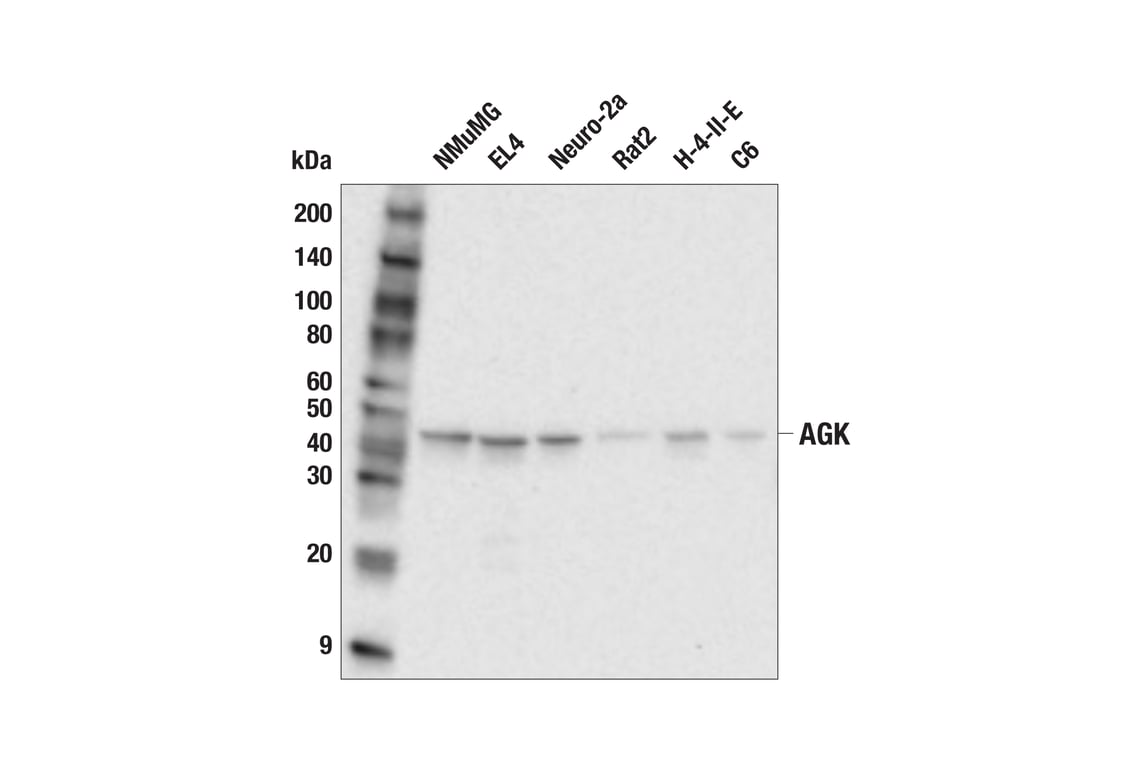 Western Blotting Image 2: AGK (E1C6X) Rabbit mAb