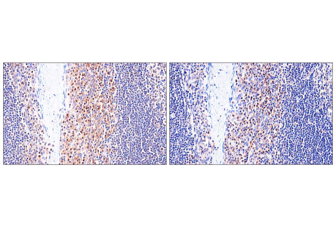 Immunohistochemistry Image 11: ADAR1 p150 Isoform (E6U1U) Rabbit mAb