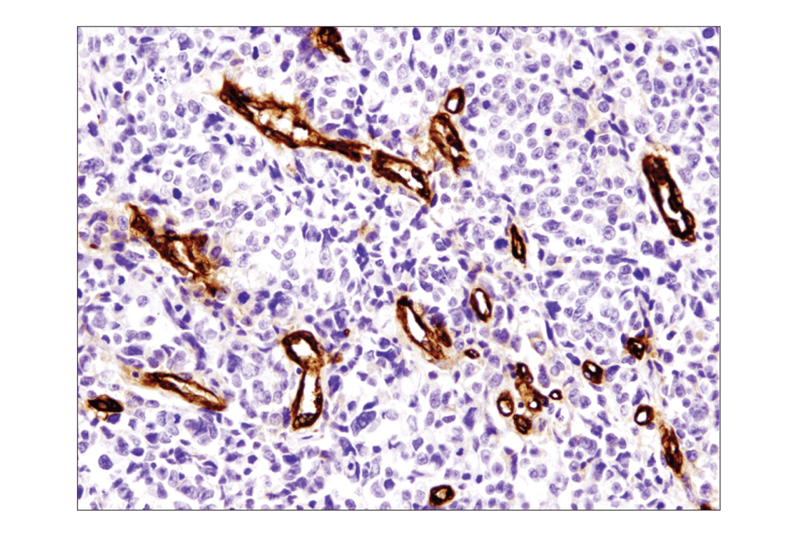Immunohistochemistry Image 1: CD36 (D8L9T) Rabbit mAb (BSA and Azide Free)