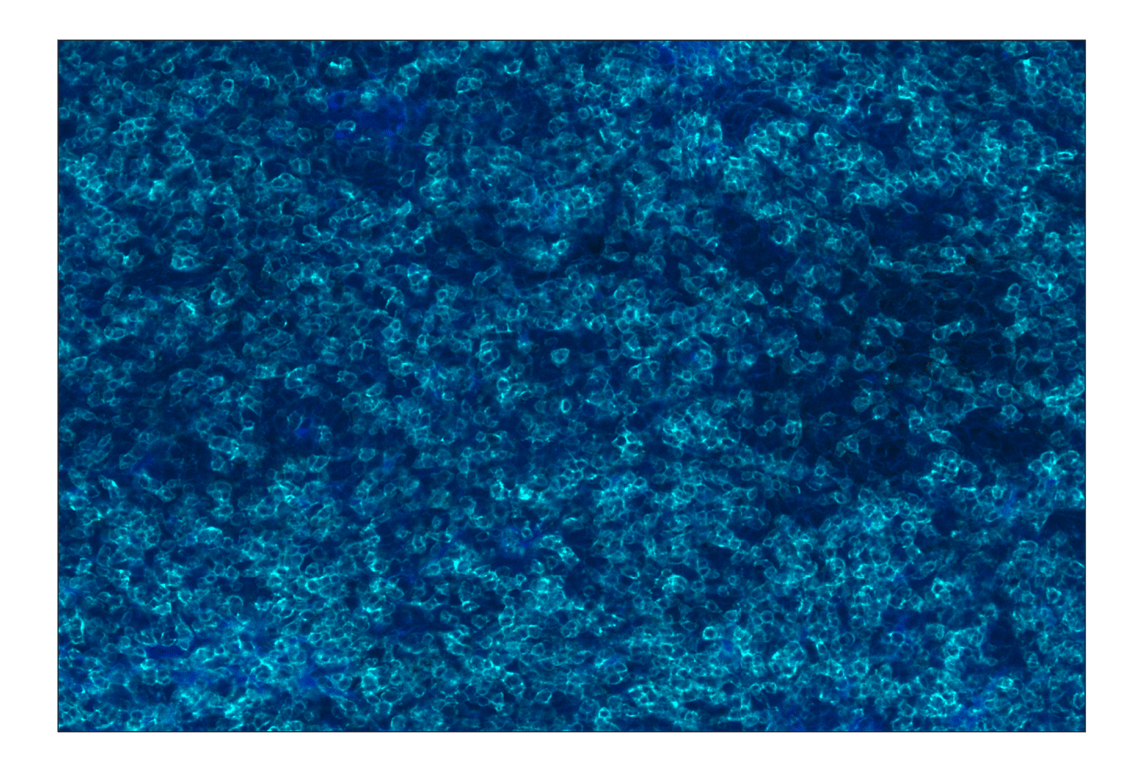 Immunohistochemistry Image 2: CD8α (D8A8Y) Rabbit mAb (Alexa Fluor<sup>®</sup> 750 Conjugate)