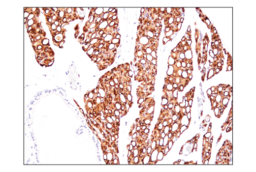 Immunohistochemistry Image 4: Perilipin-1 (D1D8) XP<sup>®</sup> Rabbit mAb