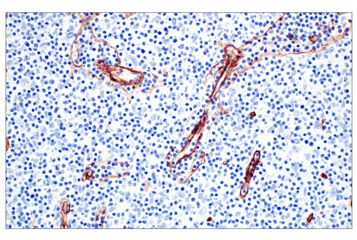 Immunohistochemistry Image 4: COL4A1 (E5M6R) Rabbit mAb (BSA and Azide Free)