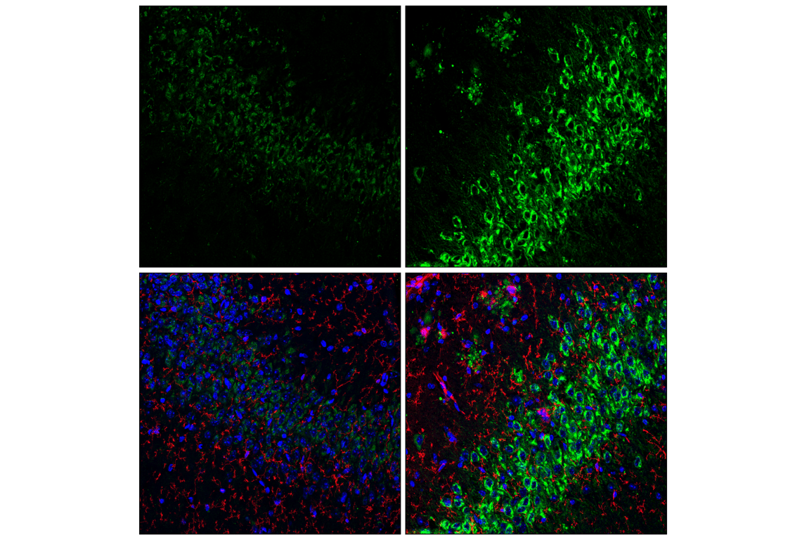 Immunofluorescence Image 1: APP (E3F3P) Rabbit mAb