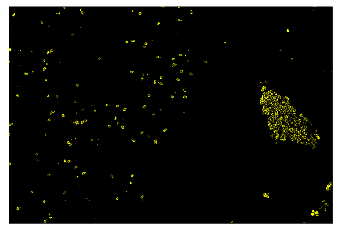 Immunohistochemistry Image 3: CD20 (E3N7O) & CO-0134-750 SignalStar<sup>™</sup> Oligo-Antibody Pair