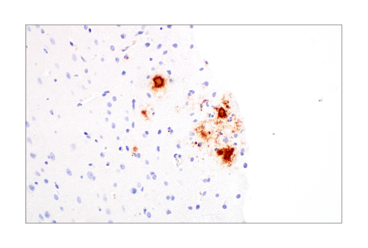 Immunohistochemistry Image 4: β-Amyloid (1-42) (E6D5M) Rabbit mAb