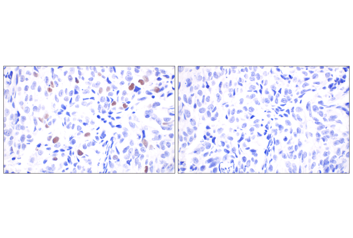 undefined Image 23: Non-Homologous End Joining (NHEJ) DNA Repair Antibody Sampler Kit