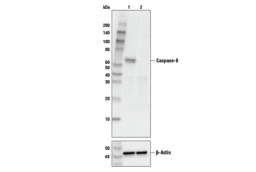 undefined Image 18: Apoptosis Antibody Sampler Kit II