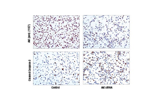 Immunohistochemistry Image 5: Akt (pan) (11E7) Rabbit mAb