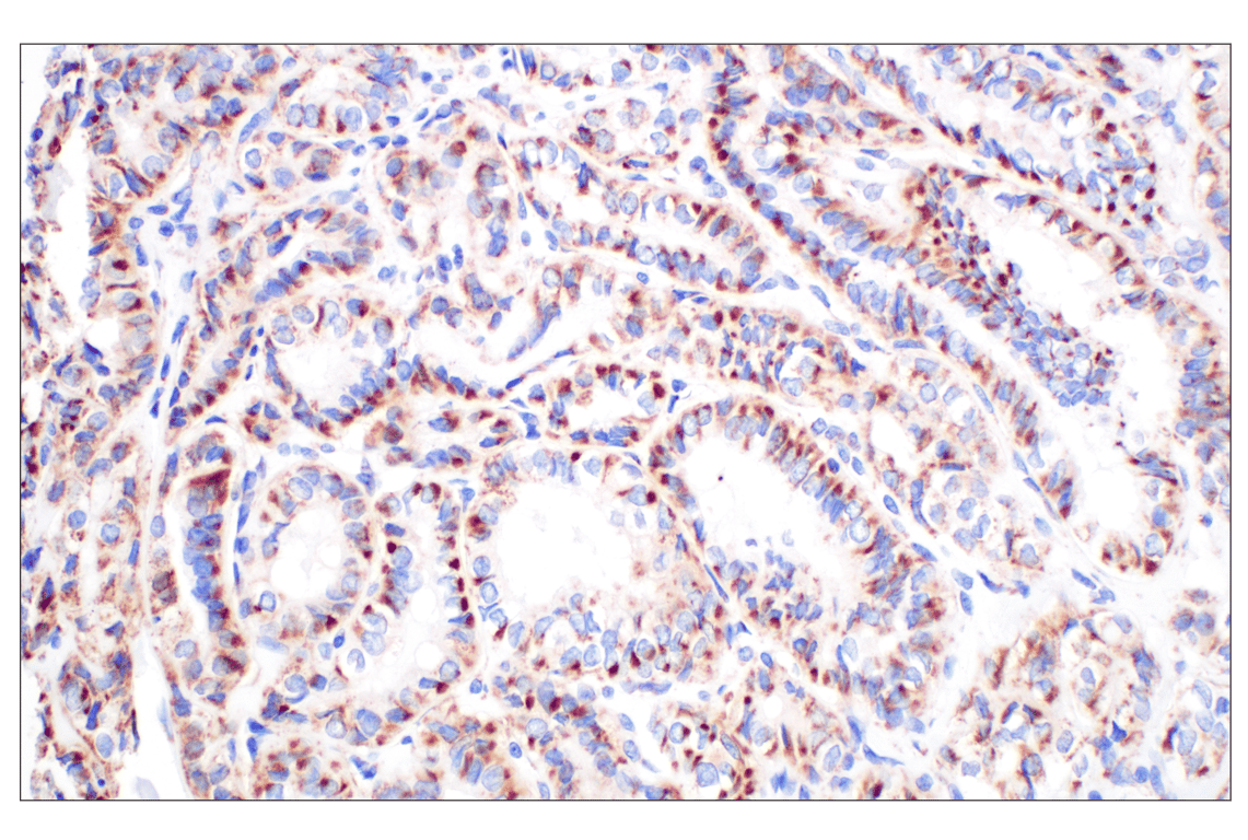 Immunohistochemistry Image 3: GCDH (F2P2M) Rabbit mAb