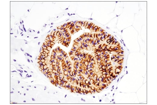 Immunohistochemistry Image 2: EpCAM (E6V8Y) XP<sup>®</sup> Rabbit mAb (BSA and Azide Free)