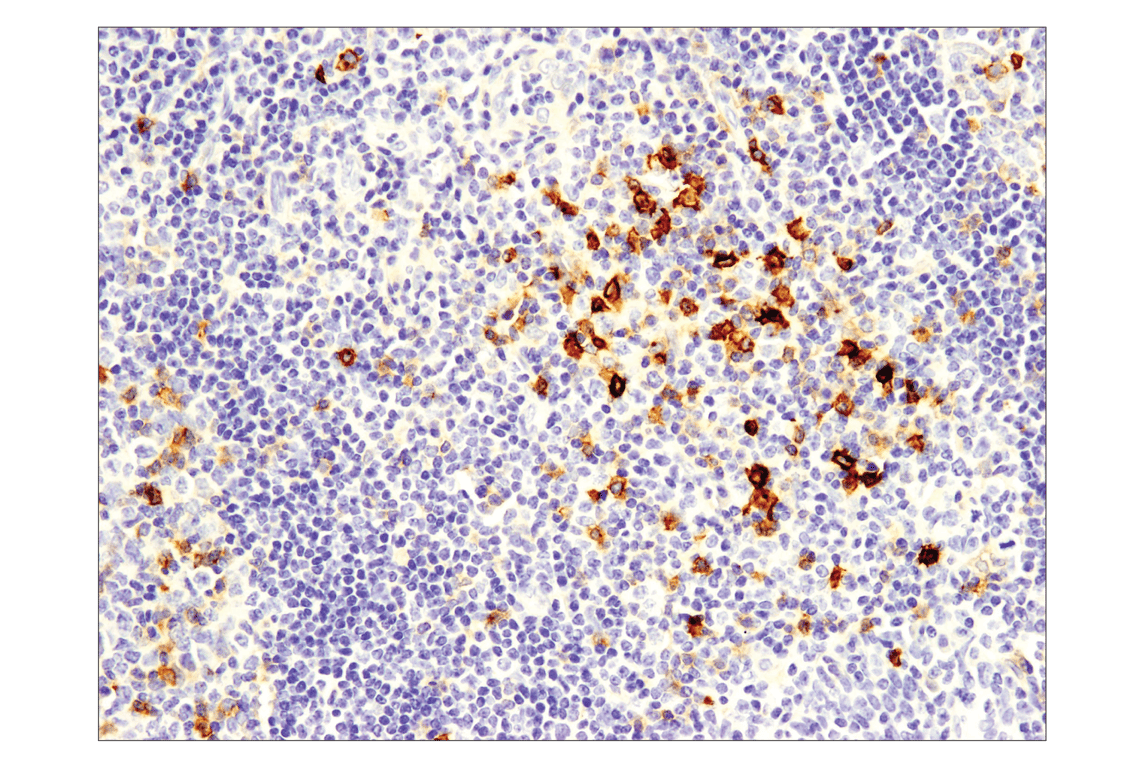 Immunohistochemistry Image 1: OX40 (E9U7O) XP<sup>®</sup> Rabbit mAb (BSA and Azide Free)