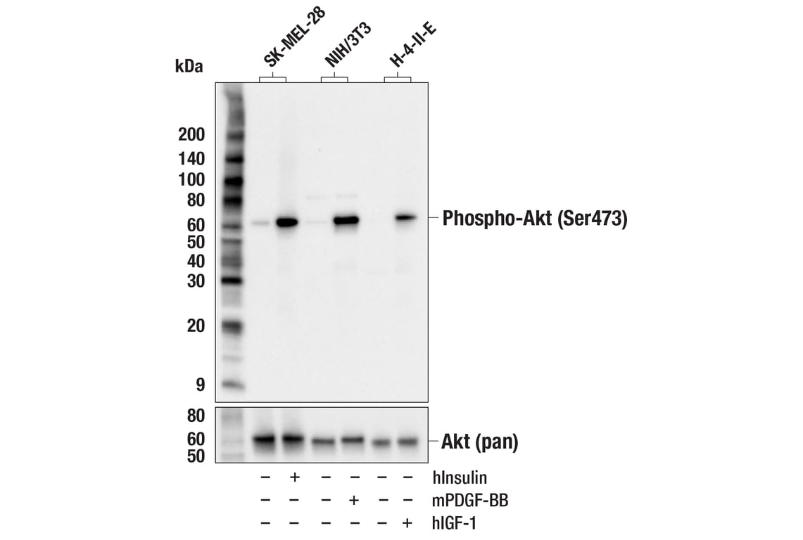 Western Blotting Image 1: Phospho-Akt (Ser473) (E4U3U) Mouse mAb