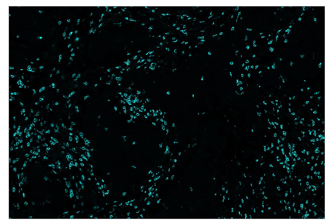 Immunohistochemistry Image 5: CD8α (D8A8Y) & CO-0004-647 SignalStar<sup>™</sup> Oligo-Antibody Pair