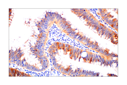 Immunohistochemistry Image 3: Glut1 (E4S6I) Rabbit mAb