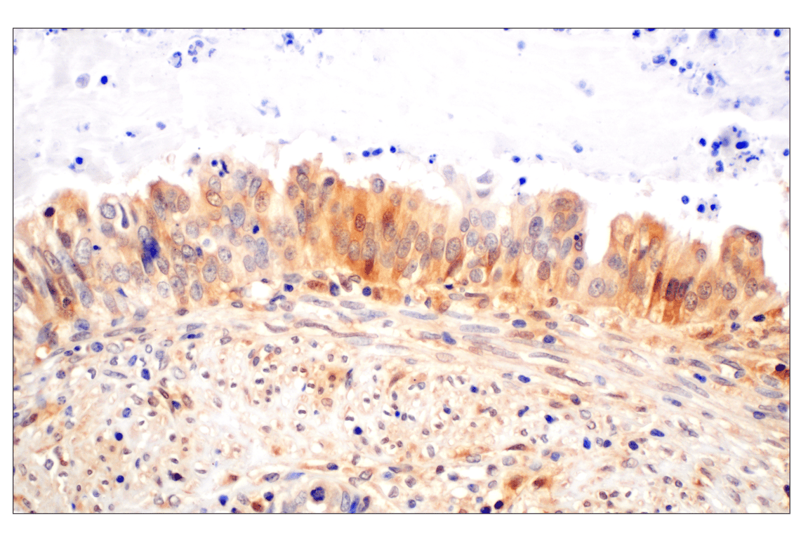 Immunohistochemistry Image 4: Galectin-8/LGALS8 (F9O3T) Rabbit mAb