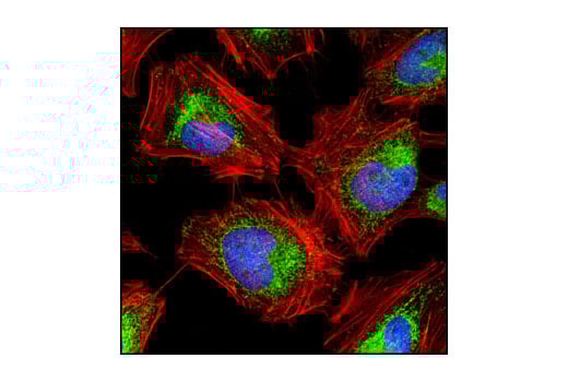 Immunofluorescence Image 1: Hexokinase I (C35C4) Rabbit mAb (BSA and Azide Free)