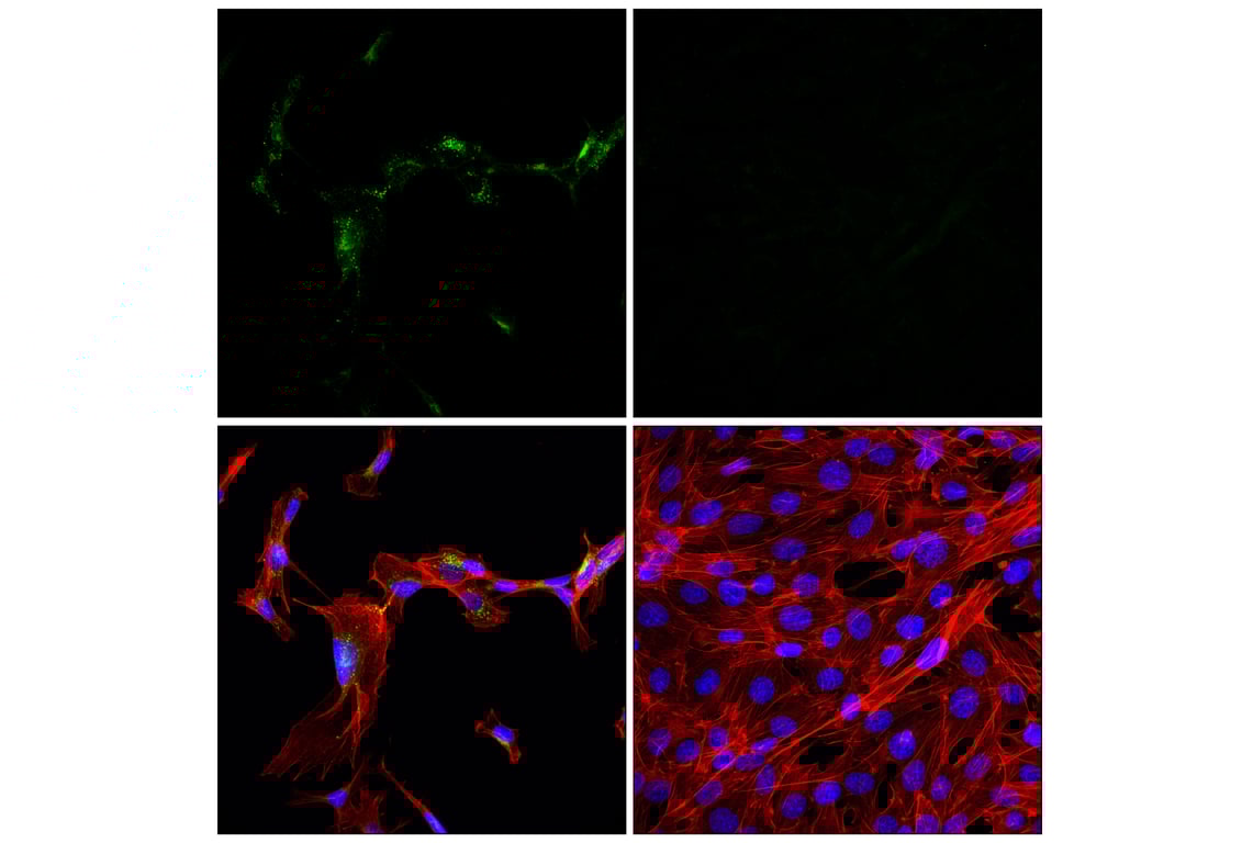 Immunofluorescence Image 1: APP (E3F3P) Rabbit mAb