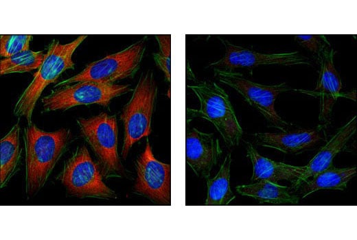 Immunofluorescence Image 1: Anti-mouse IgG (H+L), F(ab')<sub>2</sub> Fragment (Alexa Fluor<sup>®</sup> 555 Conjugate)