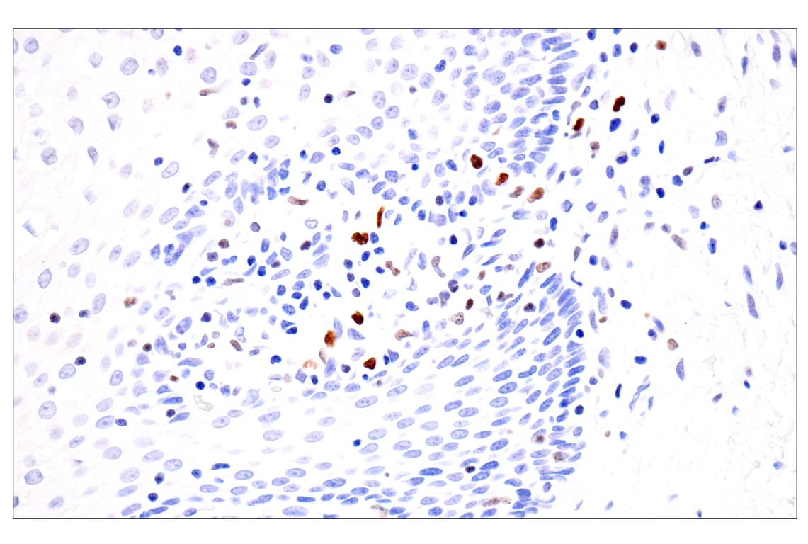 Immunohistochemistry Image 9: BATF3 (E3F3L) Rabbit mAb