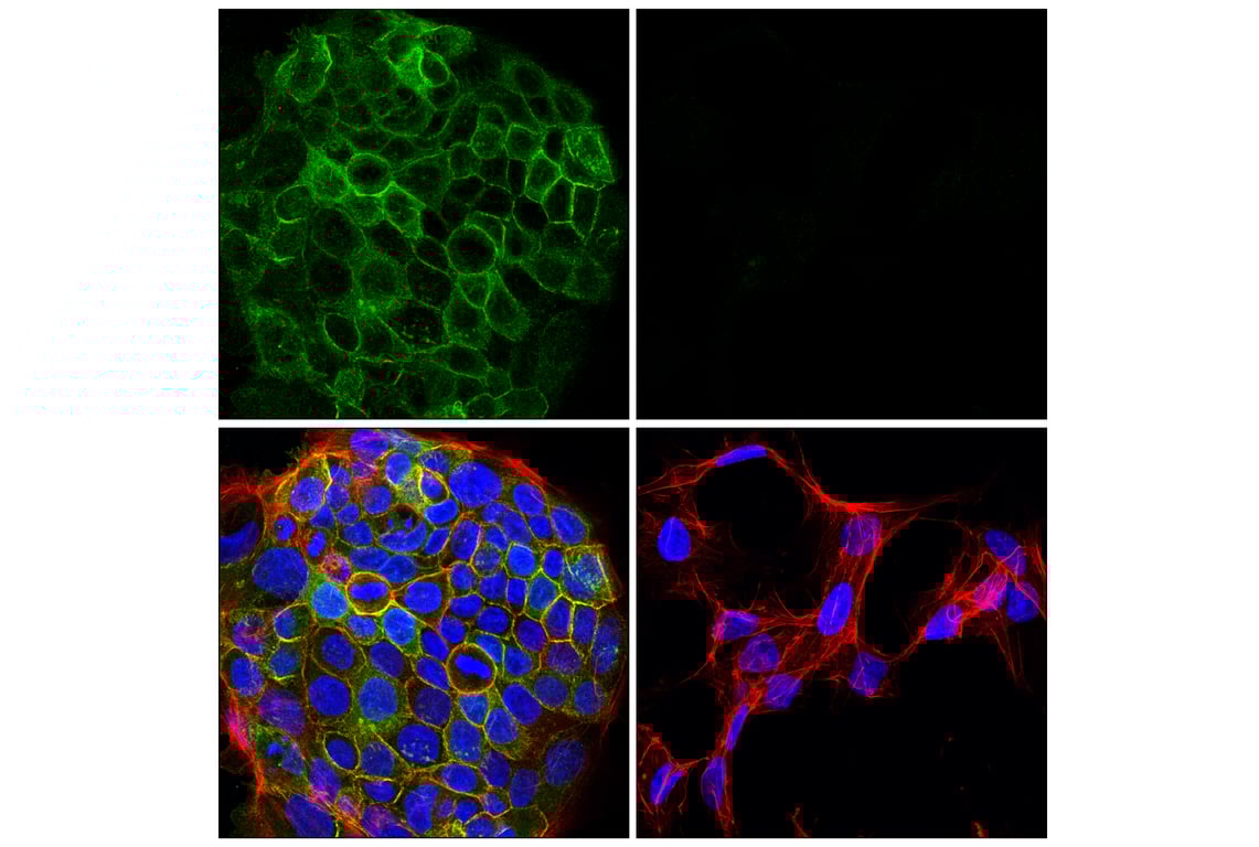 Immunofluorescence Image 1: Integrin β6 (E4M9P) XP<sup>®</sup> Rabbit mAb
