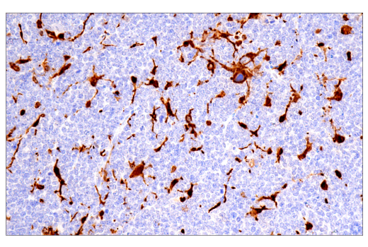 Immunohistochemistry Image 10: Galectin-3/LGALS3 (E7B6R) Rabbit mAb